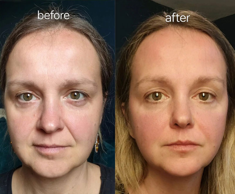 Face Splitmassage, Agnieszka Borowiec, Massage Edinburgh